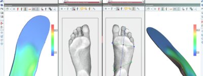 Gefräste orthopädische Einlagen mit paromed